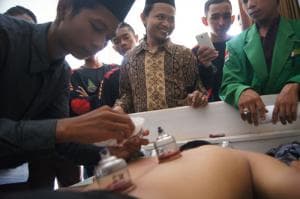 Sambut Harlah NU, Ansor Way Kanan Bekam Gratis 90 Warga