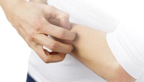 Batasan Bolehnya Menggaruk-garuk saat Shalat