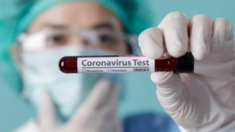 Upaya Deteksi Dini, Rapid Test Corona di DKI 10.338 Negatif dan 121 Positif