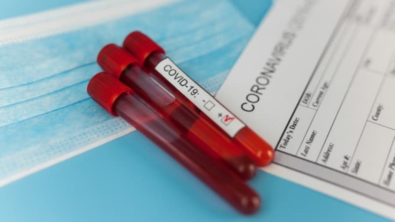 Komisi IX DPR Dukung Pemerintah Lakukan Rapid Test