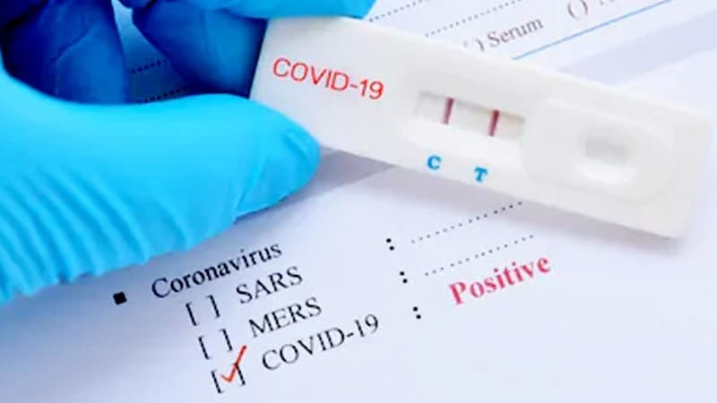Letak Kekurangan Rapid Test untuk Deteksi Virus Corona