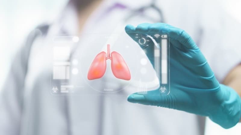 Pendekatan Multisektoral Diperlukan untuk Tangani TBC