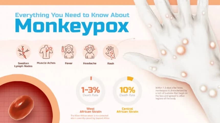 Sederet Fakta Cacar Monyet yang Kini Berstatus Darurat Global