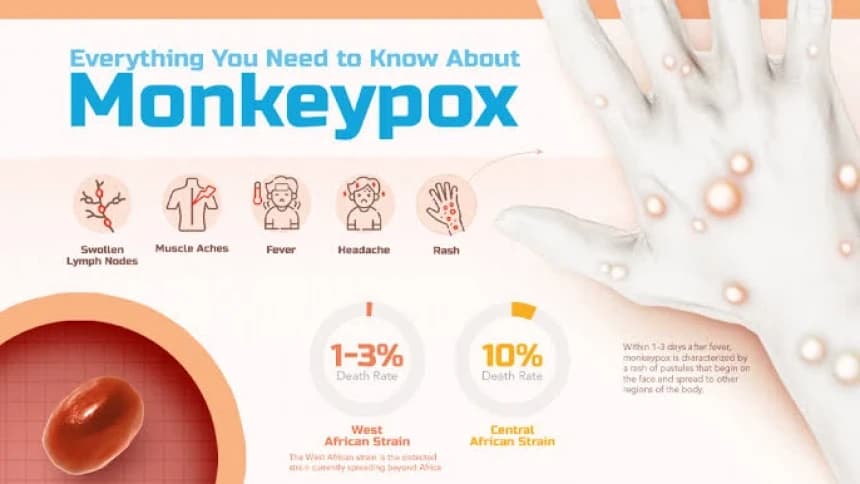 Waspadai Wabah Cacar Monyet, Bisa Menular dari Hewan ke Manusia