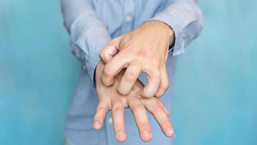 Benarkah Penderita Gudik Tak Boleh Makan Daging Ayam atau Ikan?