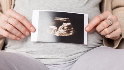 Apakah Perempuan Jelang Persalinan Tetap Wajib Shalat?