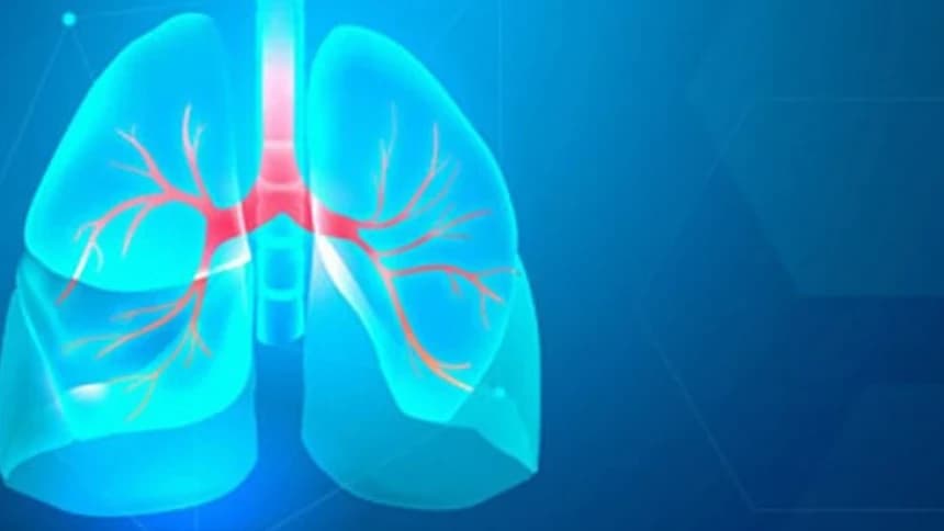 Tuberkulosis Penyakit Menular Mematikan, Pahami Gejala dan Cara Mencegahnya