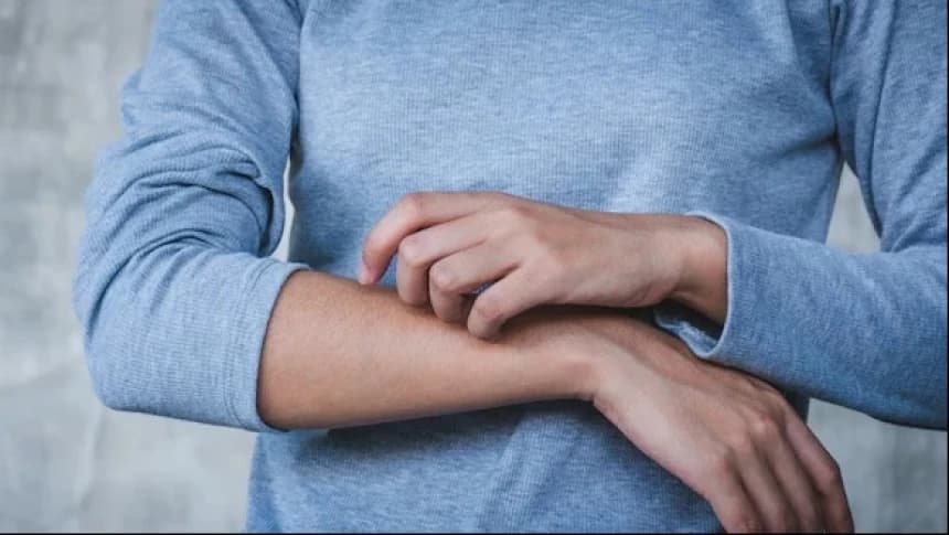 Mitos Skabies Penyakit Berkah bagi Santri