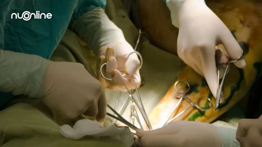 Efek Vasektomi dalam Tinjauan Thibbun Nabawi dan Farmakologi