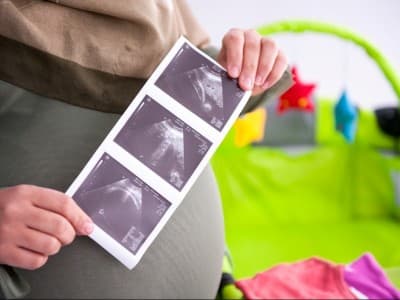 Ragam Pendapat Ulama soal Menggugurkan Kandungan