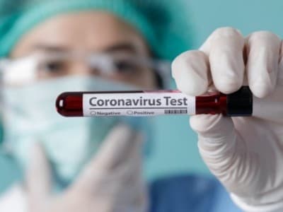 Upaya Deteksi Dini, Rapid Test Corona di DKI 10.338 Negatif dan 121 Positif