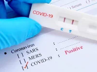 Letak Kekurangan Rapid Test untuk Deteksi Virus Corona