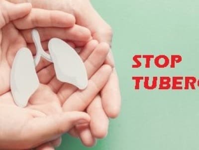 LKNU Serang Raya Perkuat Peran Kader dalam Tangani Tuberculosis