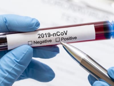 Tiga Catatan LK PBNU Terkait Batasan Tarif Tertinggi Tes RT-PCR