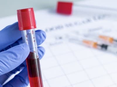 Satgas NU Ajak Penyintas Sumbang Plasma Sembuhkan Penderita Covid-19