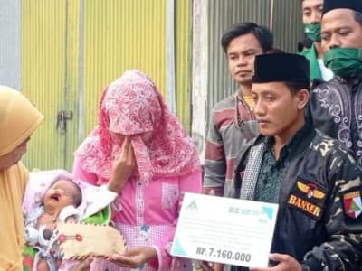 Ansor Tlanakan Pamekasan Bantu Bayi Berkelainan Jantung dan Bibir Sumbing