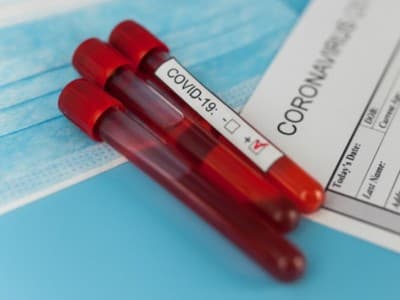 Sebelum Menerima Vaksin, Dokter NU Dukung Kebijakan Rapid Test Antigen bagi Masyarakat