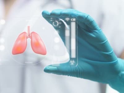 Pendekatan Multisektoral Diperlukan untuk Tangani TBC