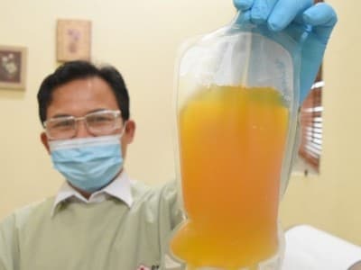 Pastikan Memenuhi Syarat sebelum Berikan Plasma Konvalesen