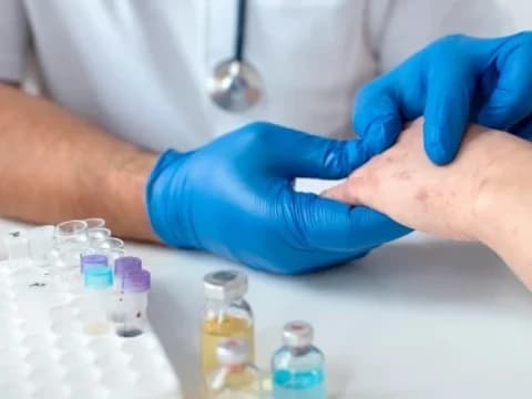 Resmi Masuk Indonesia, Begini Sejarah Penyebaran Virus Cacar Monyet