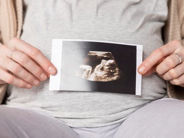 Doa agar Diberi Anak Laki-laki