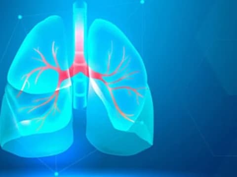 Tuberkulosis Penyakit Menular Mematikan, Pahami Gejala dan Cara Mencegahnya