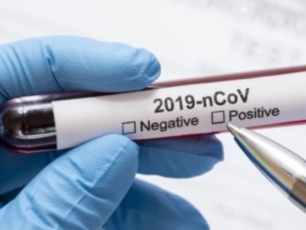 Jamin Kepastian Harga, Kemenkes Evaluasi Tarif PCR Secara Berkala