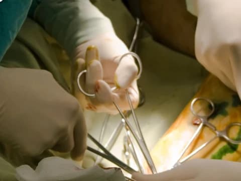 Efek Vasektomi dalam Tinjauan Thibbun Nabawi dan Farmakologi