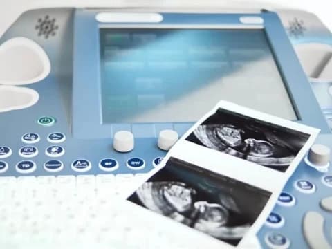 Apakah USG Transvaginal Membatalkan Puasa?