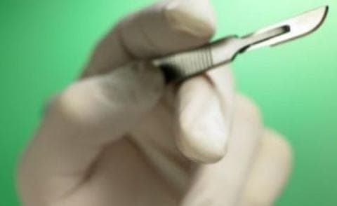 Hasil Sunat Melenceng