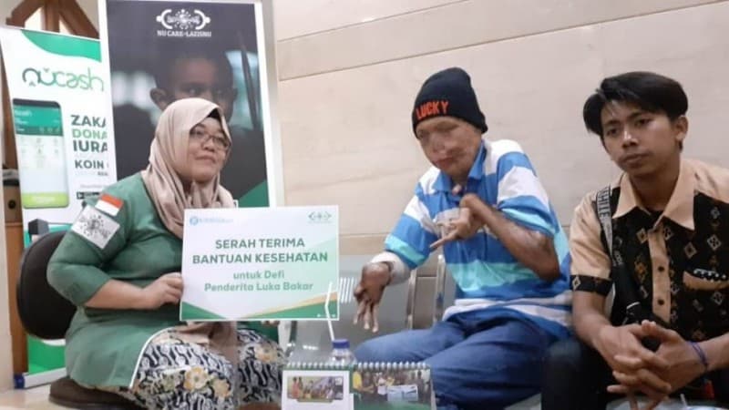 NU Care-LAZISNU Serahkan Bantuan Pengobatan untuk Penderita Luka Bakar