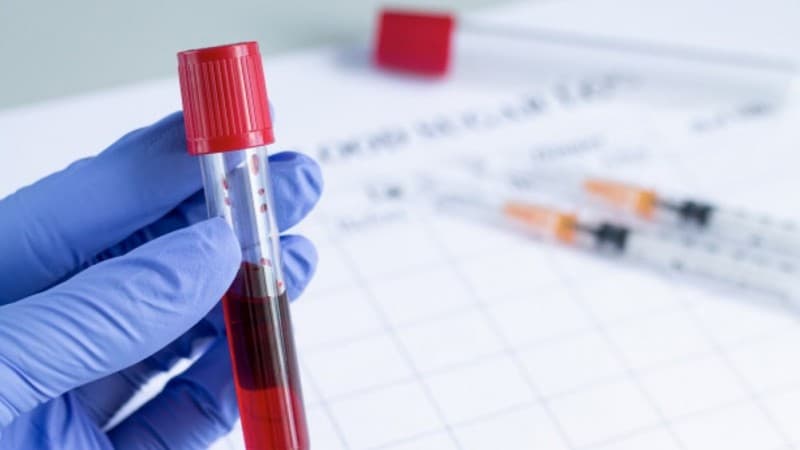 Satgas NU Ajak Penyintas Sumbang Plasma Sembuhkan Penderita Covid-19