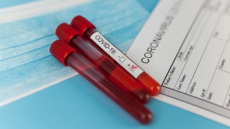 Sebelum Menerima Vaksin, Dokter NU Dukung Kebijakan Rapid Test Antigen bagi Masyarakat