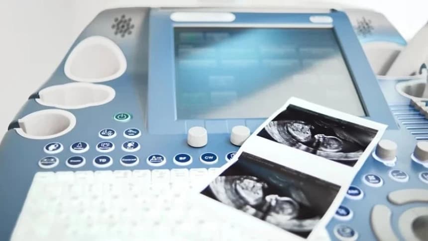 Apakah USG Transvaginal Membatalkan Puasa?